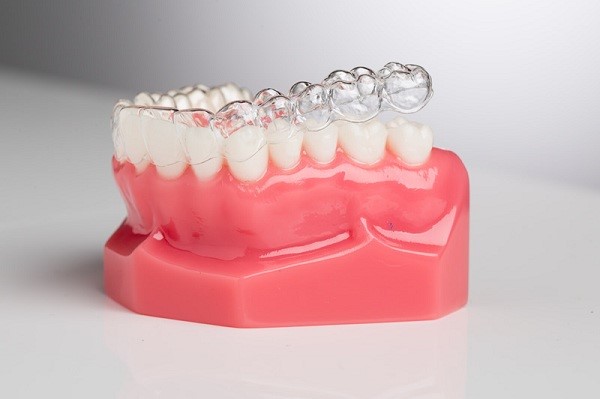 Niềng răng 3D clear aligner giúp khắc phục những khuyết điểm của hàm răng