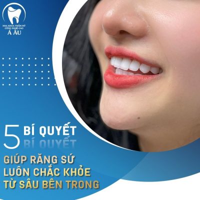 Tuân thủ các nguyên tắc chăm sóc răng sau khi bọc là vô cùng quan trọng