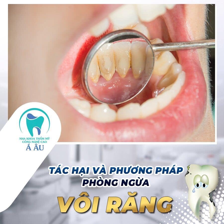 Phòng ngừa vôi răng tiết kiệm thời gian