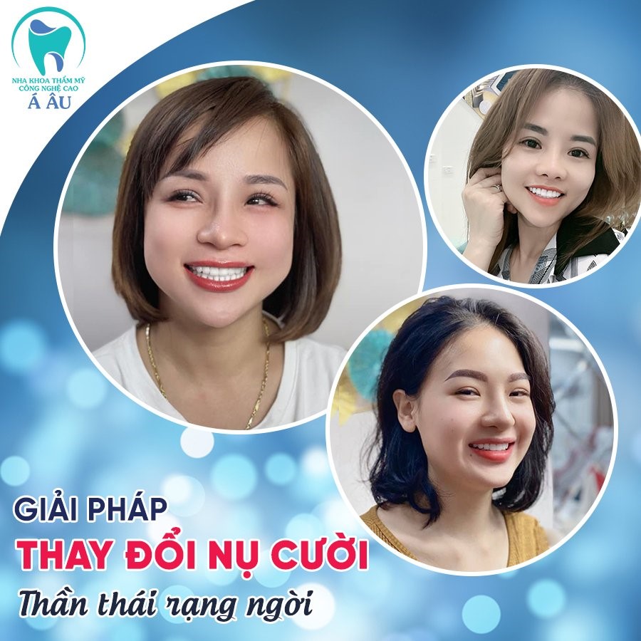 Nha khoa thẩm mỹ công nghệ cao Á Âu – nơi thay đổi nụ cười