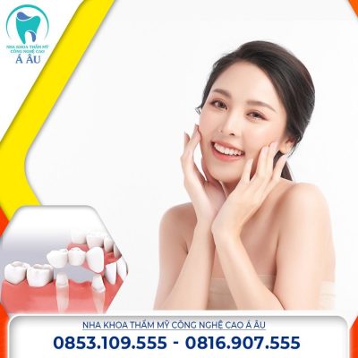 Răng sứ đem lại nụ cười rạng rỡ