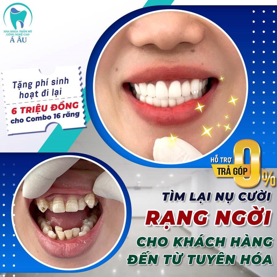 Với nha khoa Á Âu vừa đẹp vừa không lo ê răng