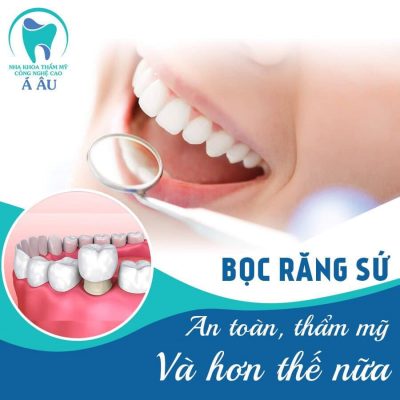 Bọc răng sứ cho nụ cười xinh