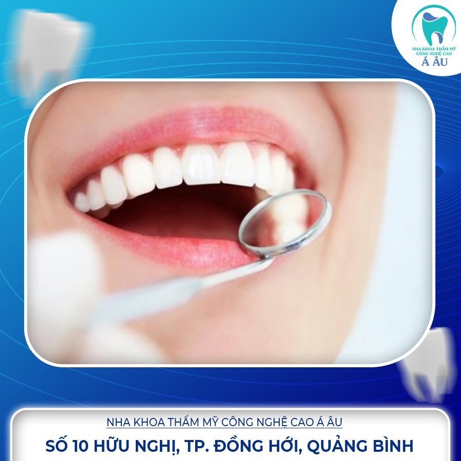 Nha khoa thẩm mỹ công nghệ cao Á Âu – địa chỉ nha khoa nhổ răng khôn bạn không nên bỏ qua