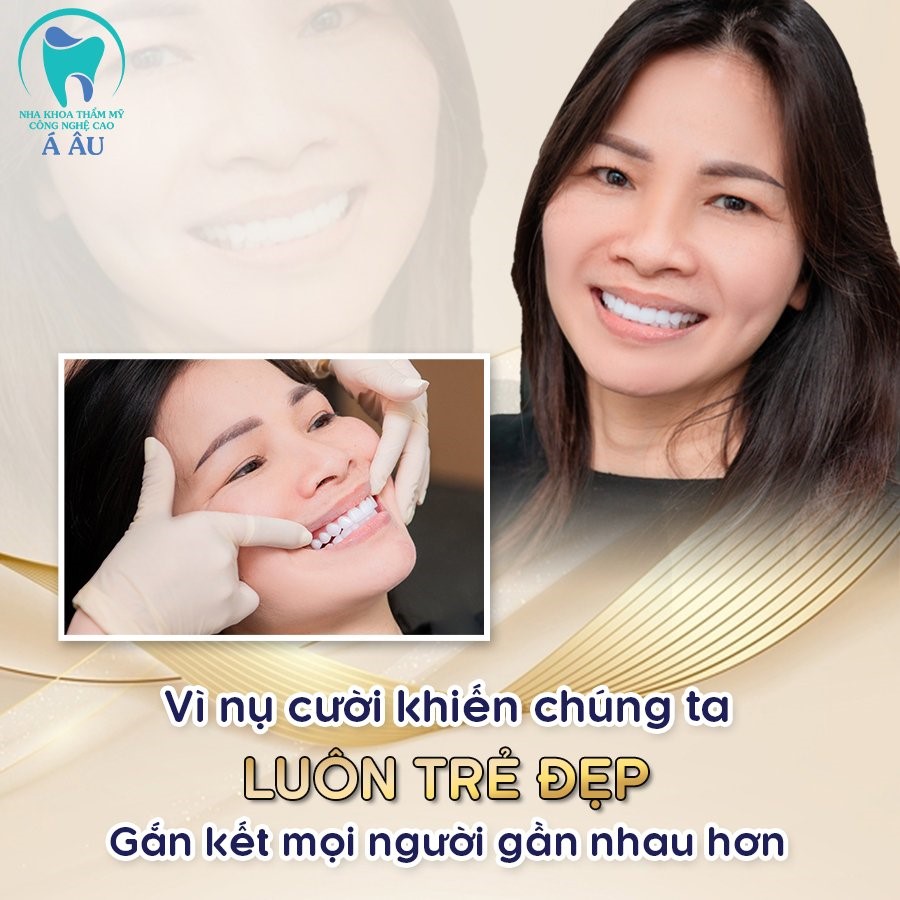 Tẩy trắng răng để khiến nụ cười luôn trắng sáng