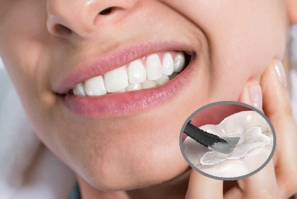 Trám răng bằng amalgam có thể gây ra tình trạng ê buốt