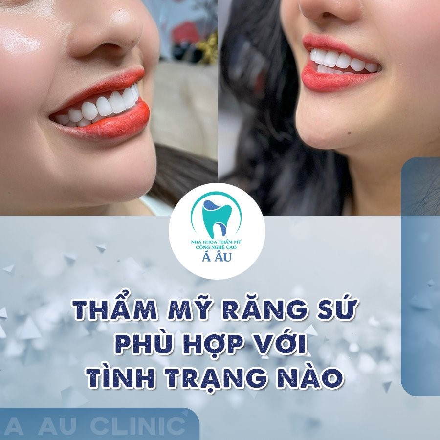 Nụ cười em là nắng cho lòng anh thêm ngẩn ngơ