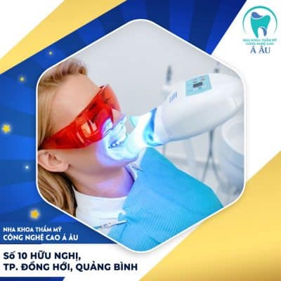 Làm trắng răng bằng công nghệ Laser được đánh giá là hiệu quả nhất