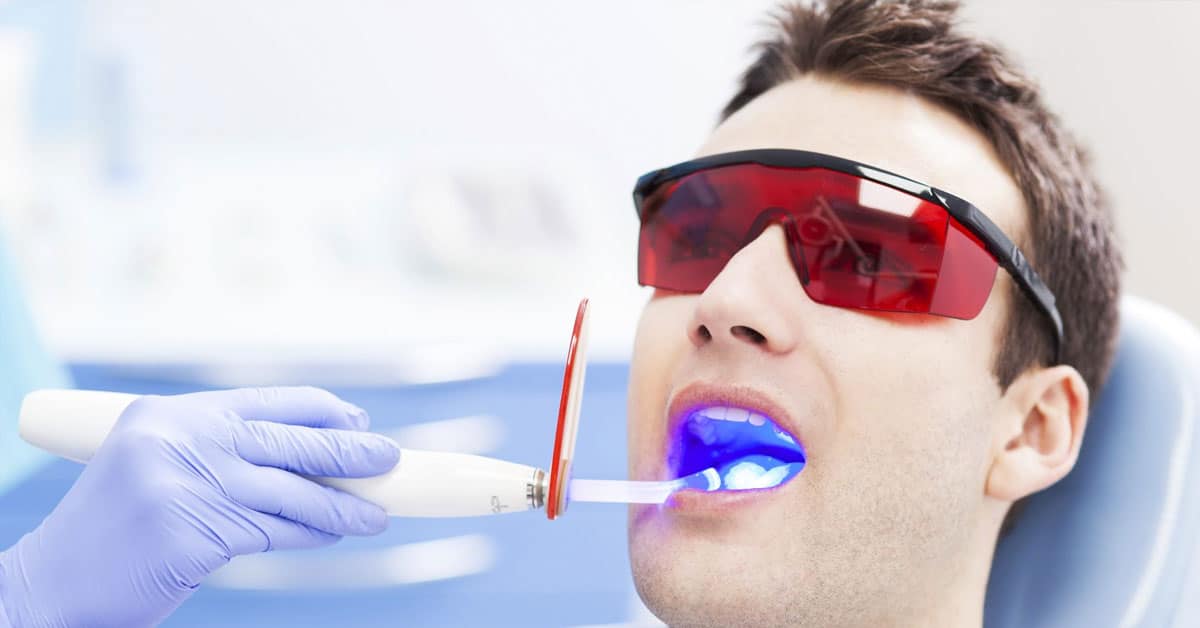 Quy trình tẩy trắng răng bằng công nghệ Laser Whitening