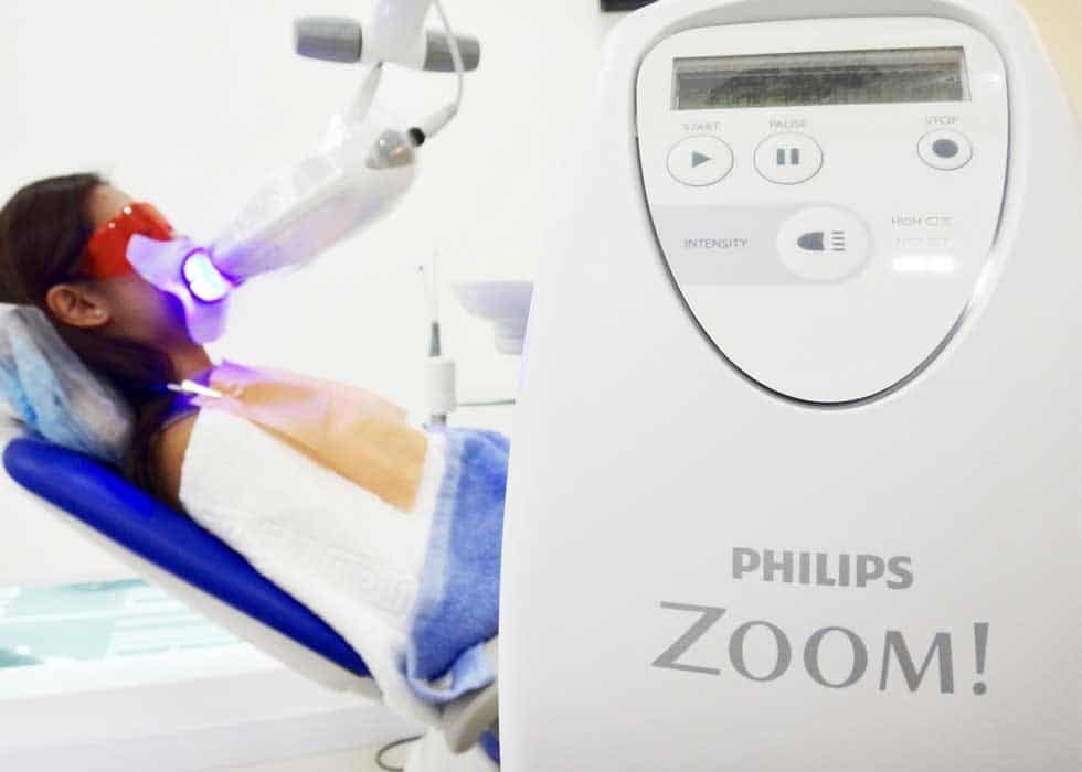 Tẩy trắng răng cùng công nghệ Laser Zoom II hiện đại