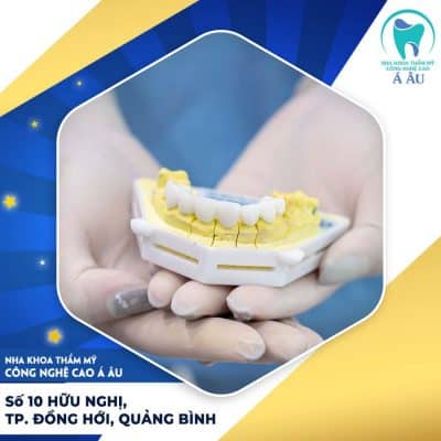 Bọc răng sứ ceramill phù hợp cho nhiều đối tượng khách hàng