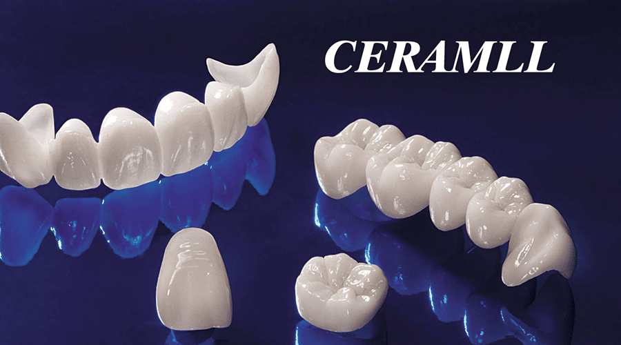 Răng sứ Ceramill là xu hướng thẩm mỹ phổ biến hiện nay