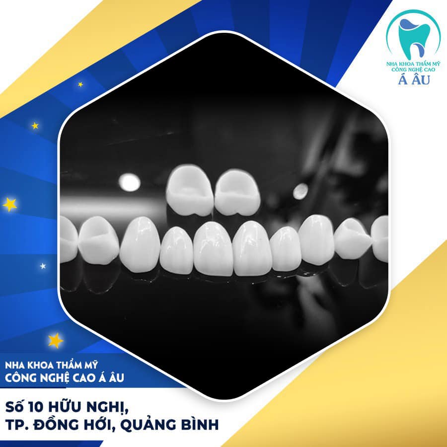 Răng sứ Zirconia đang là xu hướng thẩm mỹ hiện nay