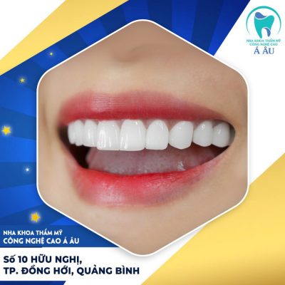 Nha khoa Á Âu mang đến bạn một nụ cười tỏa sáng