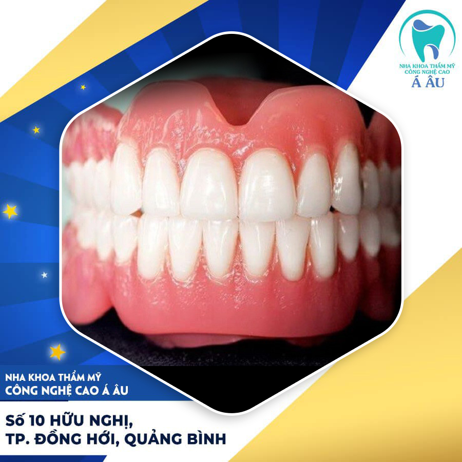 Bọc răng sứ 2 hàm là phương pháp được lựa chọn nhiều hiện nay