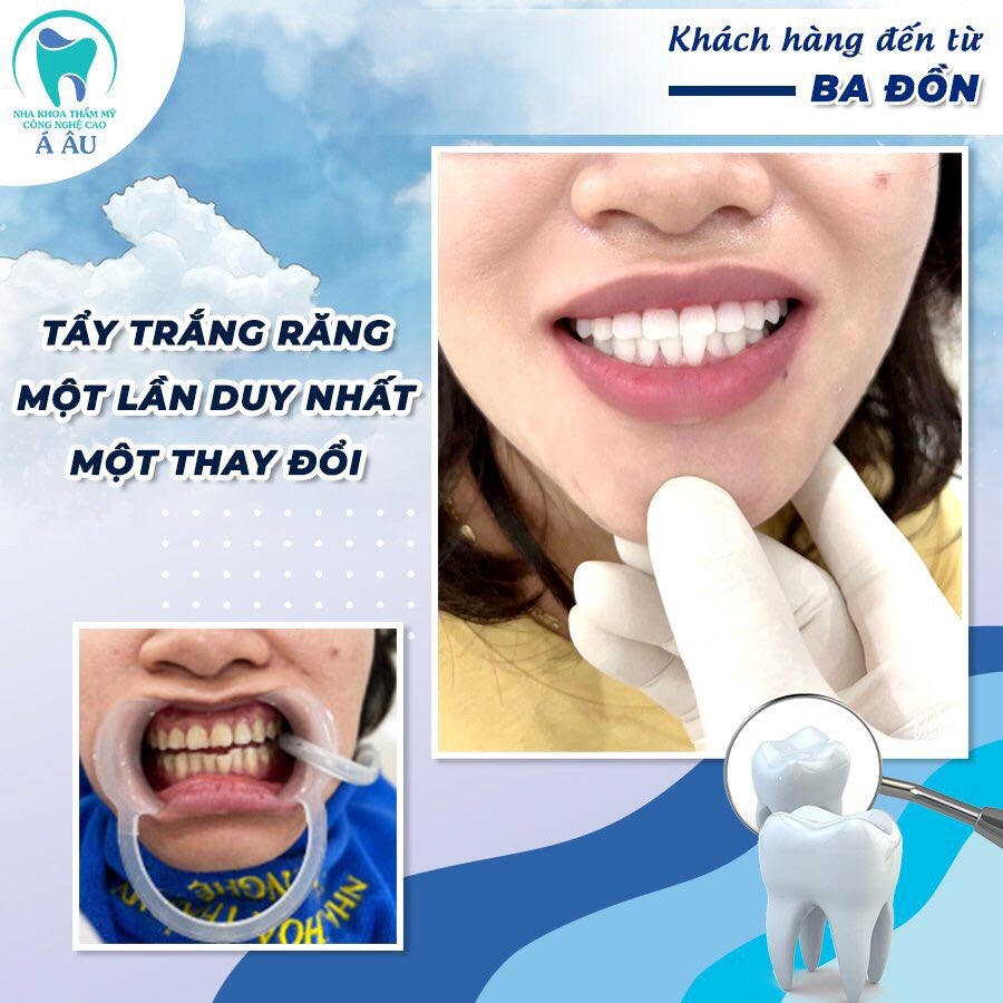 Lựa chọn nha khoa uy tín để được sử dụng dịch vụ tốt nhất