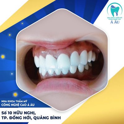 Nha khoa Á Âu nổi tiếng với những dịch vụ giá rẻ nhưng chất lượng