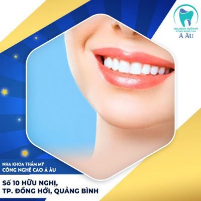 Quy trình làm răng sứ chuẩn giúp bạn sở hữu nụ cười khỏe đẹp
