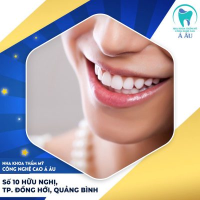 Răng sứ ngọc trai mang đến sự quý phái, sang trọng