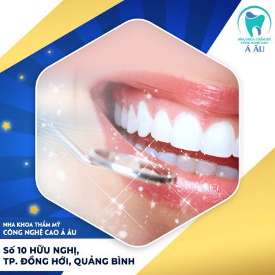 Chọn nha khoa uy tín để bọc răng sứ không đau