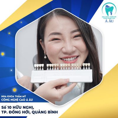 Bọc răng sứ chất lượng tại nha khoa uy tín