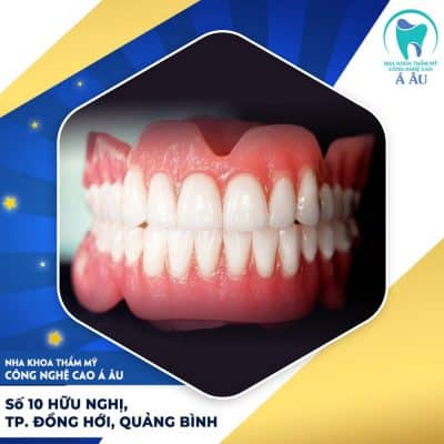 Bọc răng sứ hai hàm là phương pháp được lựa chọn nhiều hiện nay