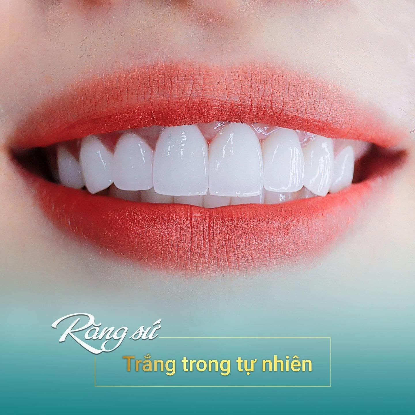 Làm răng sứ công nghệ mới đem lại khách hàng nụ cười tự nhiên