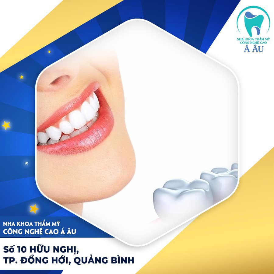 Cấy ghép implant là phương pháp bọc sứ hiện đại nhất hiện nay