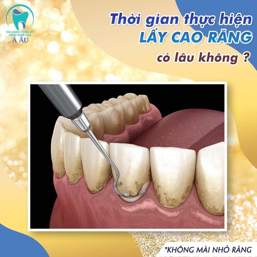 Phòng ngừa vôi răng tiết kiệm thời gian với công nghệ lấy vôi răng hiện đại