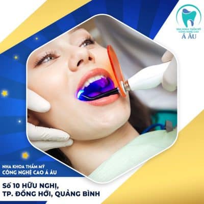 Không phải tẩy trắng răng nhiều là tốt