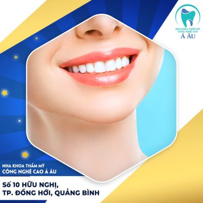 Răng sứ toàn sứ giúp khách hàng sở hữu nụ cười đẹp hoàn hảo