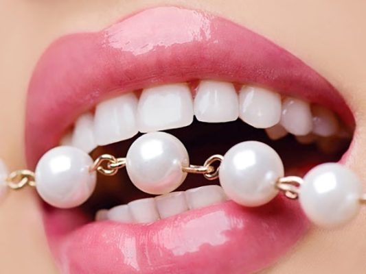 Bọc răng sứ loại ngọc trai giúp khách hàng sở hữu nụ cười tỏa sáng