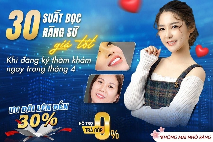 Các chương trình khuyến mãi hấp dẫn tại nha khoa uy tín