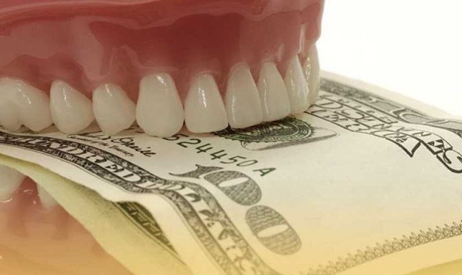 Chi phí làm răng sứ ở Nhật có cao không?