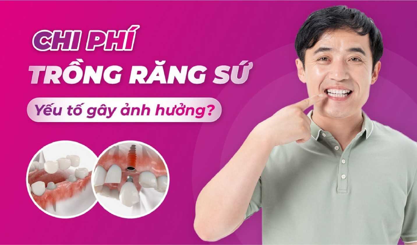 Chi phí trồng răng sứ ảnh hưởng bởi nhiều yếu tố