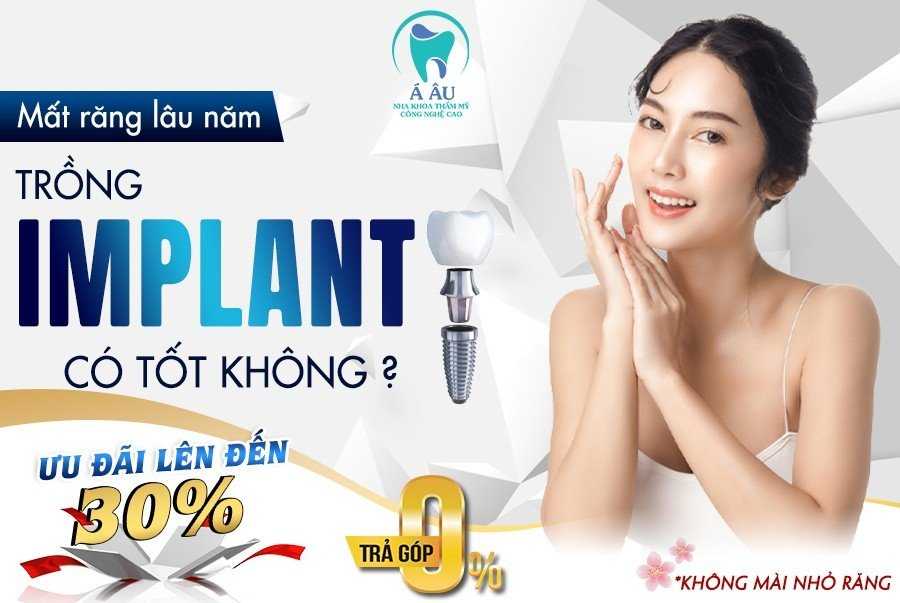 Vị trí ảnh hưởng như thế nào đến tuổi thọ của răng Implant?