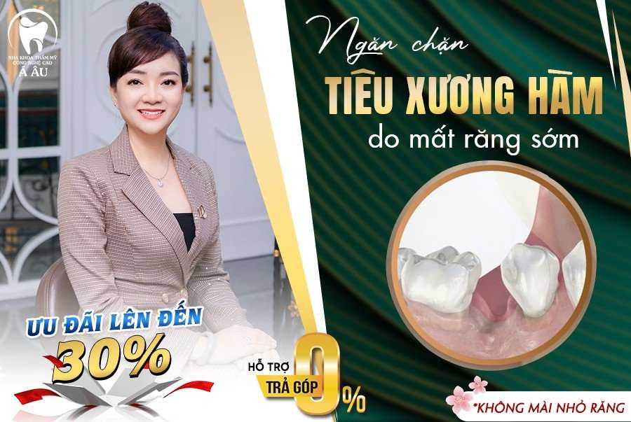 Ngăn chặn tiêu xương hàm do mất răng với phương pháp trồng răng Implant