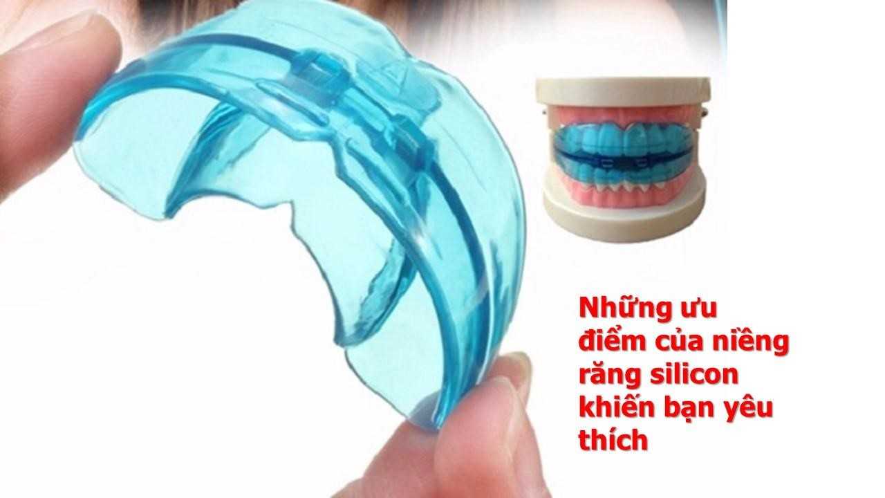 Những ưu điểm của niềng răng bằng khay silicon là gì?