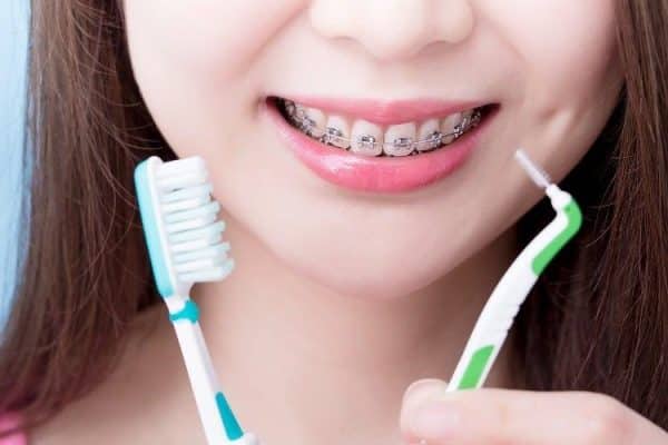 Chăm sóc răng miệng đúng cách sau niềng răng rất quan trọng