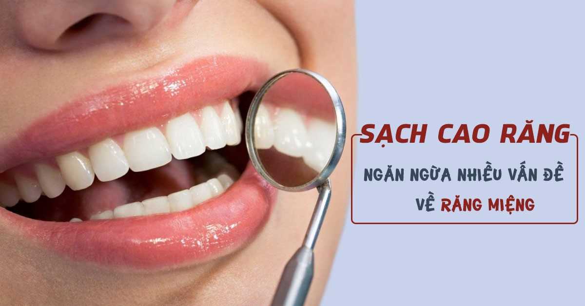 Ngăn ngừa bệnh lý răng miệng nhờ lấy cao răng định kỳ tại nha khoa