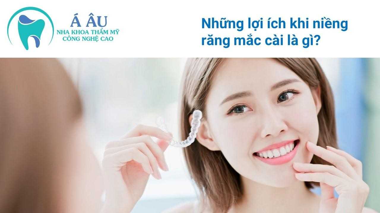 Niềng răng giúp bạn có một nụ cười tỏa sáng đầy cuốn hút