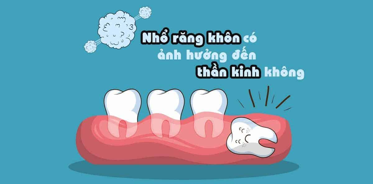 Kỹ thuật nhổ răng tốt sẽ không ảnh hưởng nhiều đến thần kinh răng