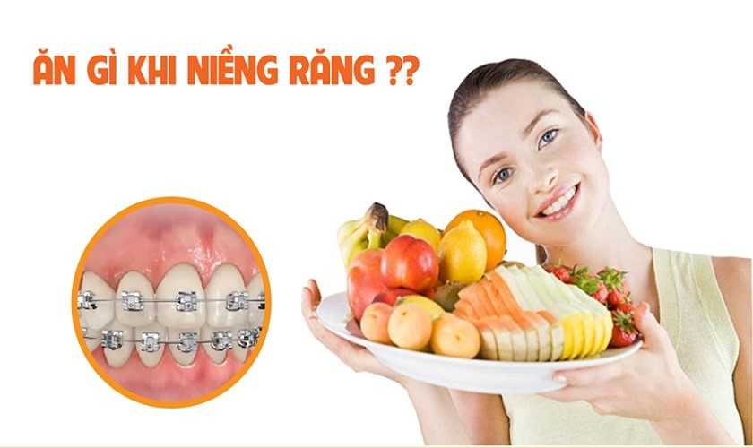 Mới niềng răng nên ăn gì?