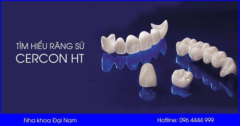 Răng sứ Cercon HT được nhiều người yêu thích