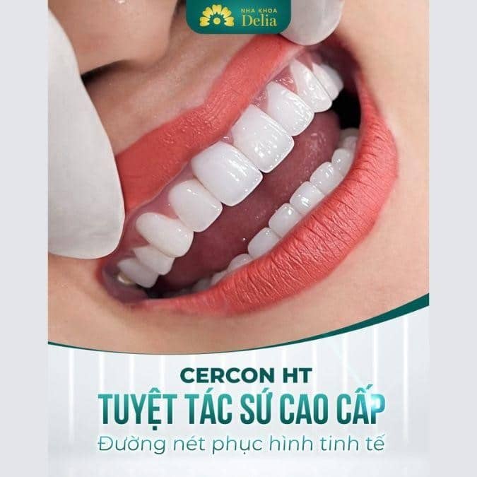 Những ưu điểm vượt trội của răng sứ Cercon HT là gì?