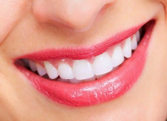 Tuân thủ nguyên tắc sau bọc răng sứ để giữ răng sứ bền lâu