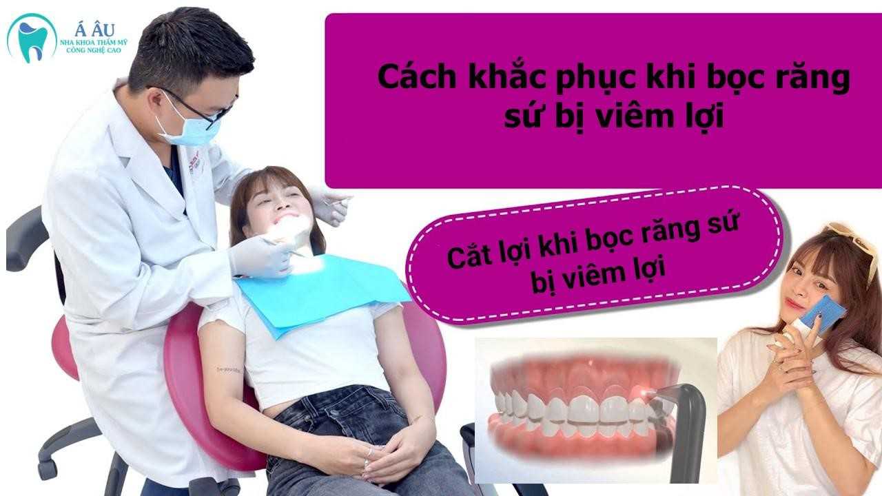 Khi bị viêm lợi nhẹ thì điều trị bằng cắt bớt lợi